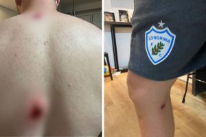 Londrina x Floresta: confusão pós-jogo termina com balas de borracha no VGD