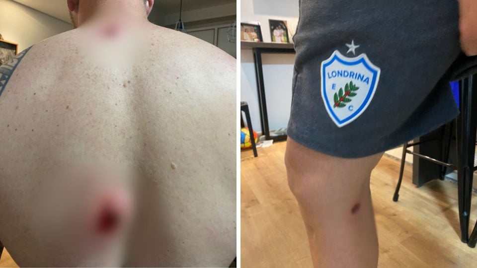 Londrina x Floresta: confusão pós-jogo termina com balas de borracha no VGD