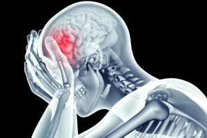 AVC é a segunda principal causa de morte no Brasil