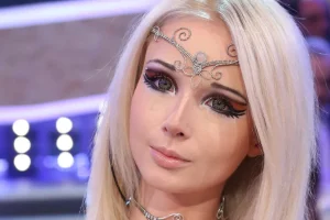 Eles gastaram fortunas para se parecerem com bonecos e estes são os resultados