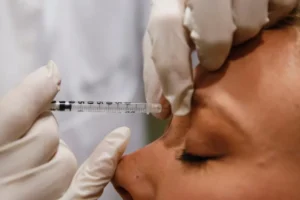 Tudo o que você precisa saber antes de aplicar Botox