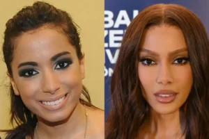 Cirurgias plásticas dos famosos: Antes e depois impressionantes!