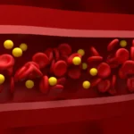 4 alimentos que ajudam a melhorar o colesterol e protegem o coração