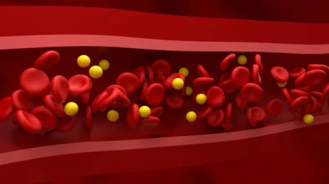 4 alimentos que ajudam a melhorar o colesterol e protegem o coração