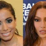 Antes e depois das cirurgias plásticas dos famosos: Os procedimentos que eles fizeram!