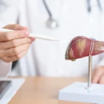 Dê um fim à gordura no fígado com estes chás e infusões