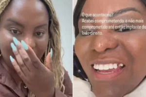 Ex-Rouge enfrenta imprevisto dental antes do Carnaval