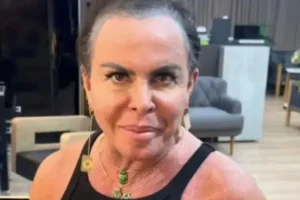 Gretchen aparece sem prótese capilar e anuncia doação de lace