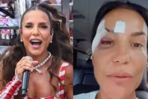 Síncope Vasovagal: O que é a síndrome que levou Ivete Sangalo a desmaiar