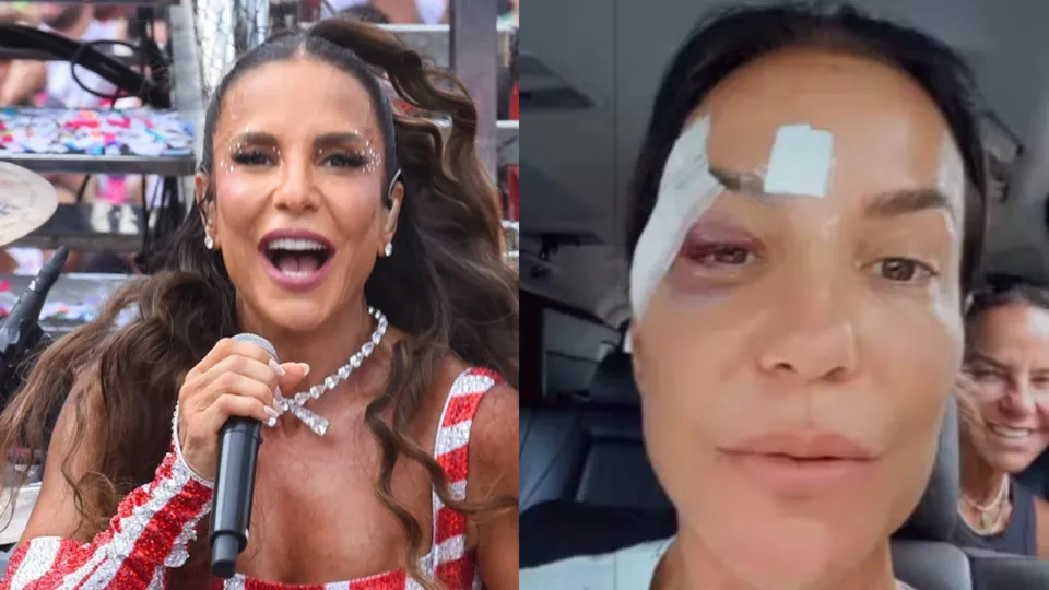 Síncope Vasovagal: O que é a síndrome que levou Ivete Sangalo a desmaiar