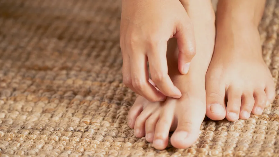 Verão e saúde da pele: dicas para evitar micoses, frieiras e foliculite