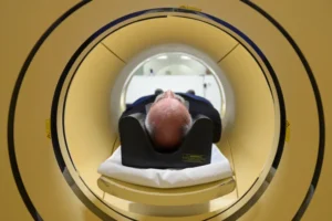 Alzheimer é a segunda doença mais temida pelos brasileiros, atrás apenas do câncer