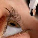 Compartilhar colírio pode causar 4 doenças nos olhos