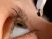 Compartilhar colírio pode causar 4 doenças nos olhos