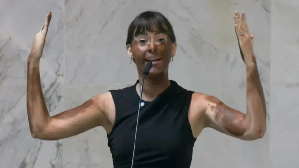 Deputada Fabiana Bolsonaro faz 'blackface' em protesto transfóbico