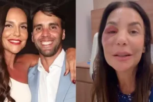 Ex-marido de Ivete fala sobre a cirurgia da cantora: 'Mulher de aço'