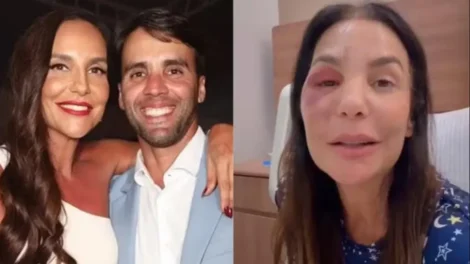 Ex-marido de Ivete fala sobre a cirurgia da cantora: 'Mulher de aço'