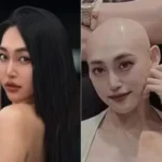 Influenciadora confunde câncer com lesão e morre aos 29 anos