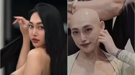 Influenciadora confunde câncer com lesão e morre aos 29 anos