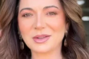 Karina Lucco abre o coração sobre alopecia e mostra evolução do cabelo