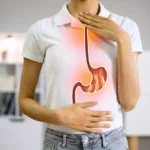 Médicos revelam os piores alimentos para quem sofre de azia