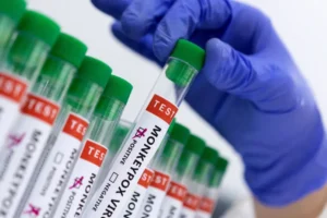Mpox aumenta no Brasil e reacende alerta para monitoramento e vigilância