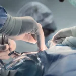 Mulher sofre dano cerebral grave após cirurgia simples