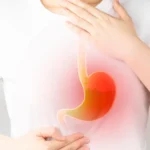 Remédios caseiros para acabar com o refluxo e aliviar a azia