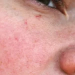 Sinais sutis de envelhecimento que você precisa prestar atenção