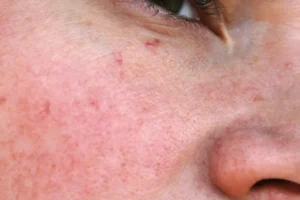 Sinais sutis de envelhecimento que você precisa prestar atenção