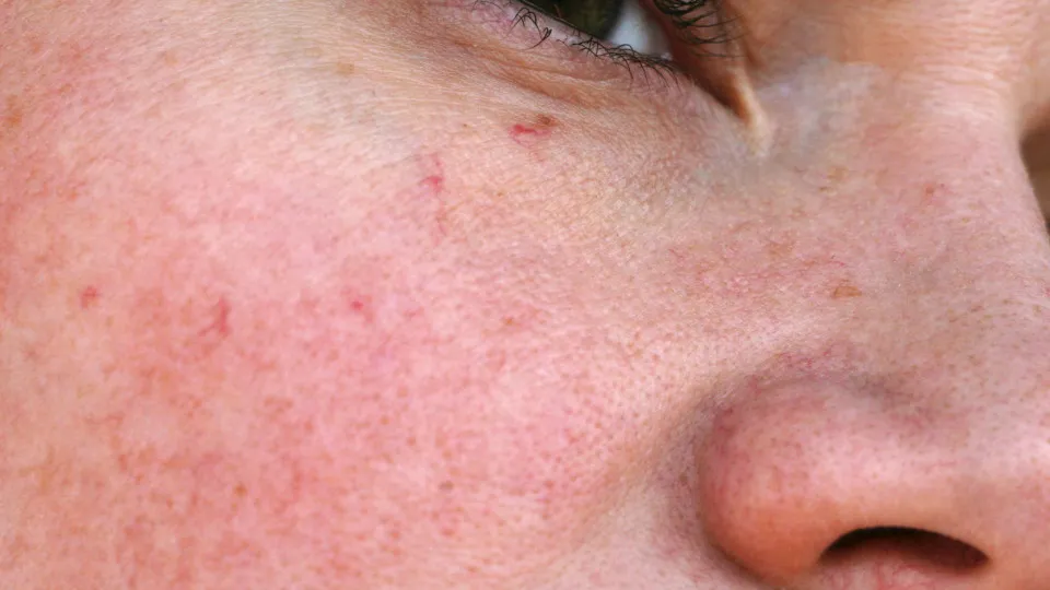 Sinais sutis de envelhecimento que você precisa prestar atenção