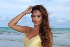 Suzanna Freitas abre o jogo sobre os desafios de conviver com hiperidrose