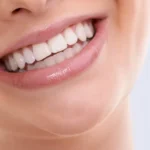 4 alimentos que ajudam a deixar os dentes mais brancos