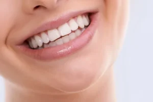 4 alimentos que ajudam a deixar os dentes mais brancos