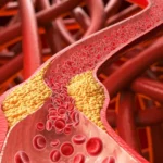 Alimento comum pode ajudar a derrubar o colesterol “ruim”