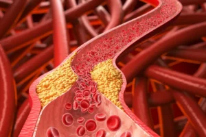 Alimento comum pode ajudar a derrubar o colesterol “ruim”