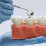 Alimentos “inofensivos” podem destruir o esmalte dos dentes; veja
