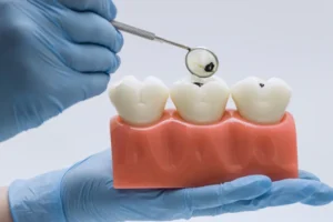 Alimentos “inofensivos” podem destruir o esmalte dos dentes; veja