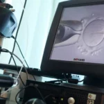 Casal branco processa clínica por erro após bebê in vitro nascer asiática