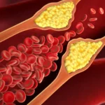 Colesterol alto? Estes alimentos baratos ajudam a reduzir os níveis