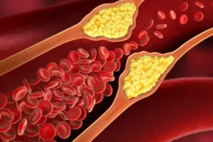 Colesterol alto? Estes alimentos baratos ajudam a reduzir os níveis