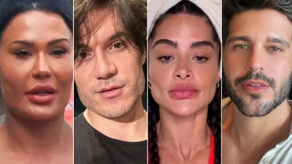 Famosos voltam atrás e revertem procedimentos estéticos em busca de naturalidade