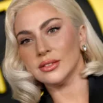 Lady Gaga cancela show por motivos de saúde: "O meu estado piorou"