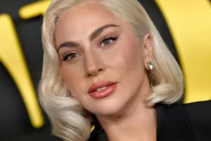 Lady Gaga cancela show por motivos de saúde: "O meu estado piorou"
