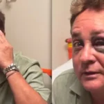 Leonardo sofre acidente em pescaria e aparece com olho roxo