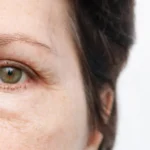 Sinais de que seu corpo está envelhecendo mais rápido que o normal