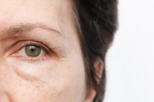 Sinais de que seu corpo está envelhecendo mais rápido que o normal