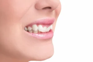 Sorriso desalinhado? Vejas 6 problemas que vão além da saúde bucal