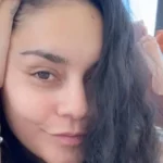 Vanessa Hudgens mostra queda de cabelo pós-parto