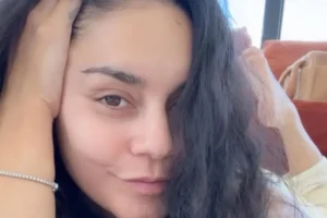 Vanessa Hudgens mostra queda de cabelo pós-parto
